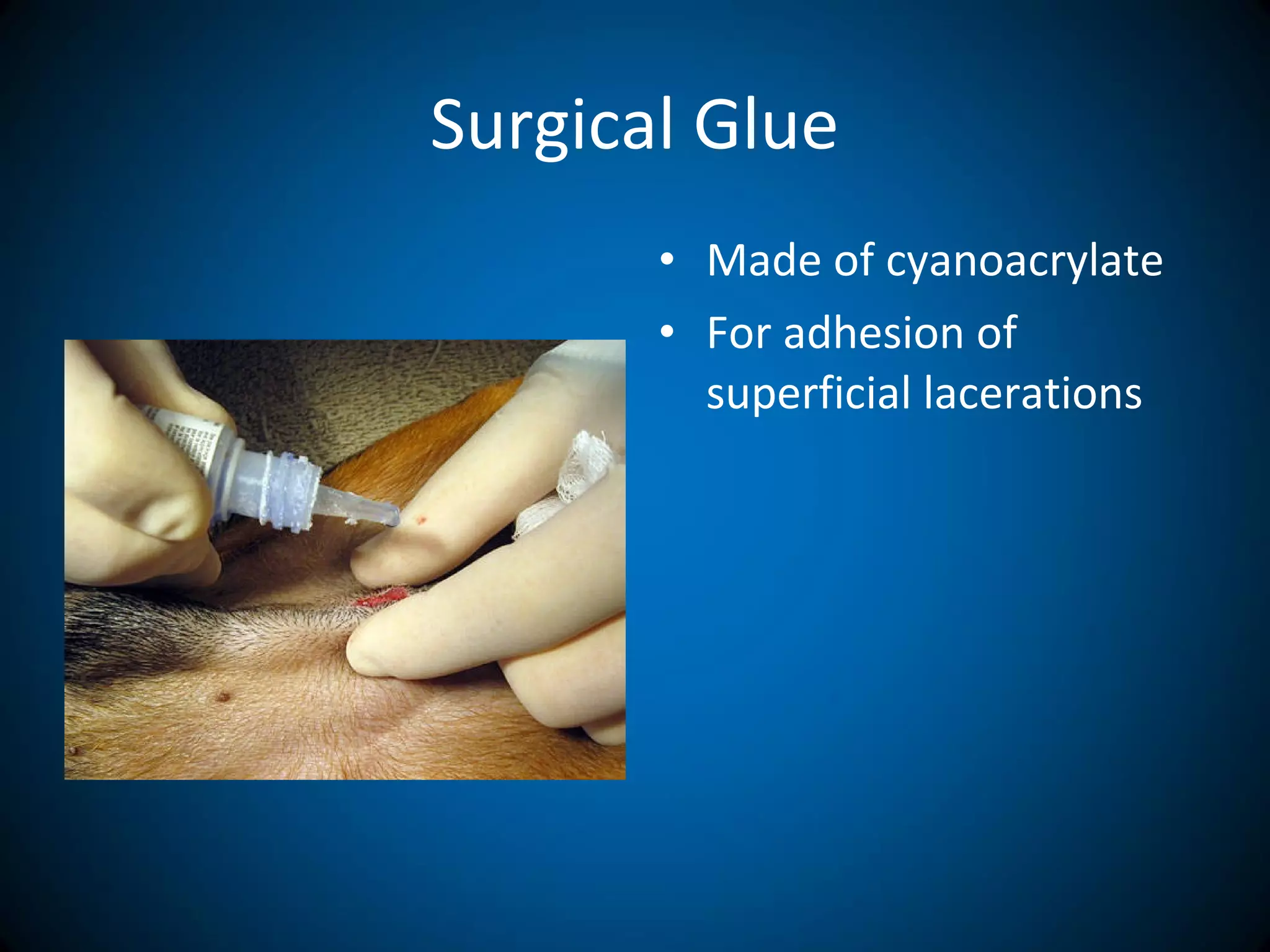 Surgical Glue
• Made of cyanoacrylate
• For adhesion of
superficial lacerations
 