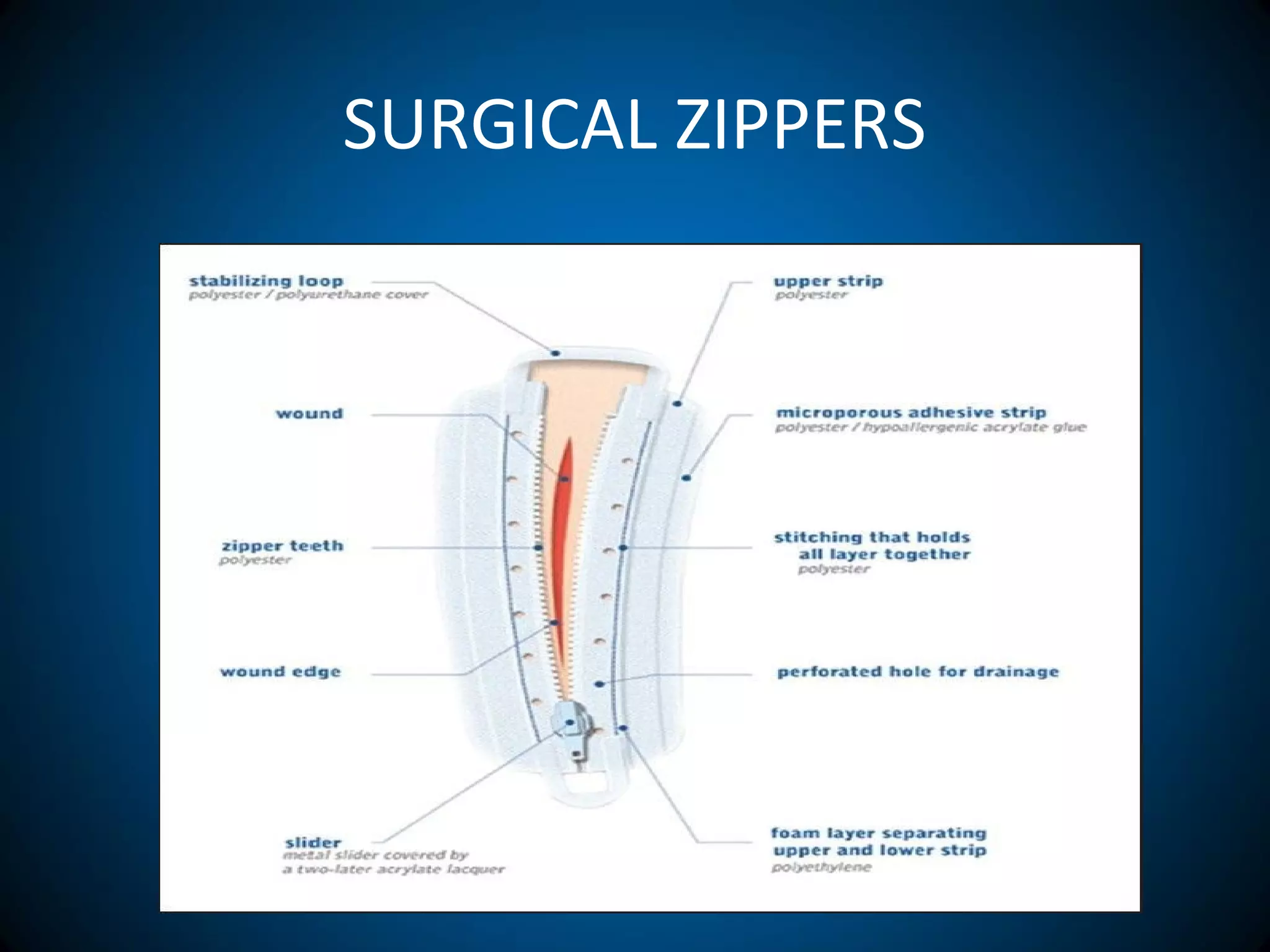 SURGICAL ZIPPERS
 