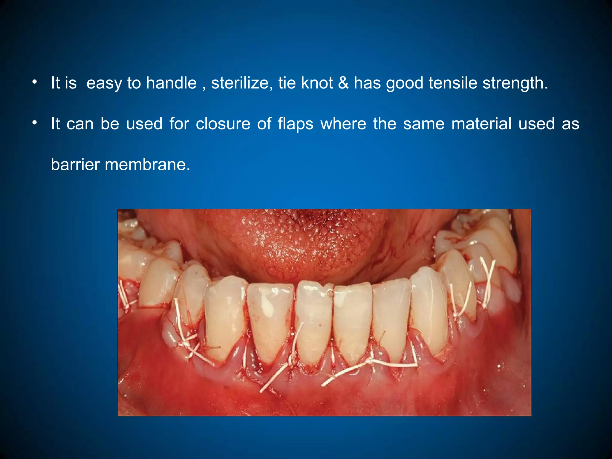 • It is easy to handle , sterilize, tie knot & has good tensile strength.
• It can be used for closure of flaps where the same material used as
barrier membrane.
 
