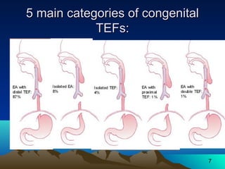 7
5 main categories of congenital5 main categories of congenital
TEFs:TEFs:
 