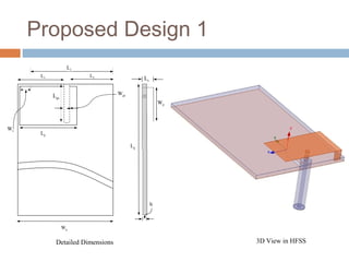 Proposed Design 1
L1
L2

L3

Wgs

Lgs

Ws

Ls

Wp

Lp
Lg

h

Wg

Detailed Dimensions

3D View in HFSS

 