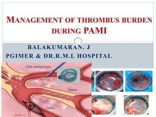 BALAKUMARAN. J
PGIMER & DR.R.M.L HOSPITAL
MANAGEMENT OF THROMBUS BURDEN
DURING PAMI
 
