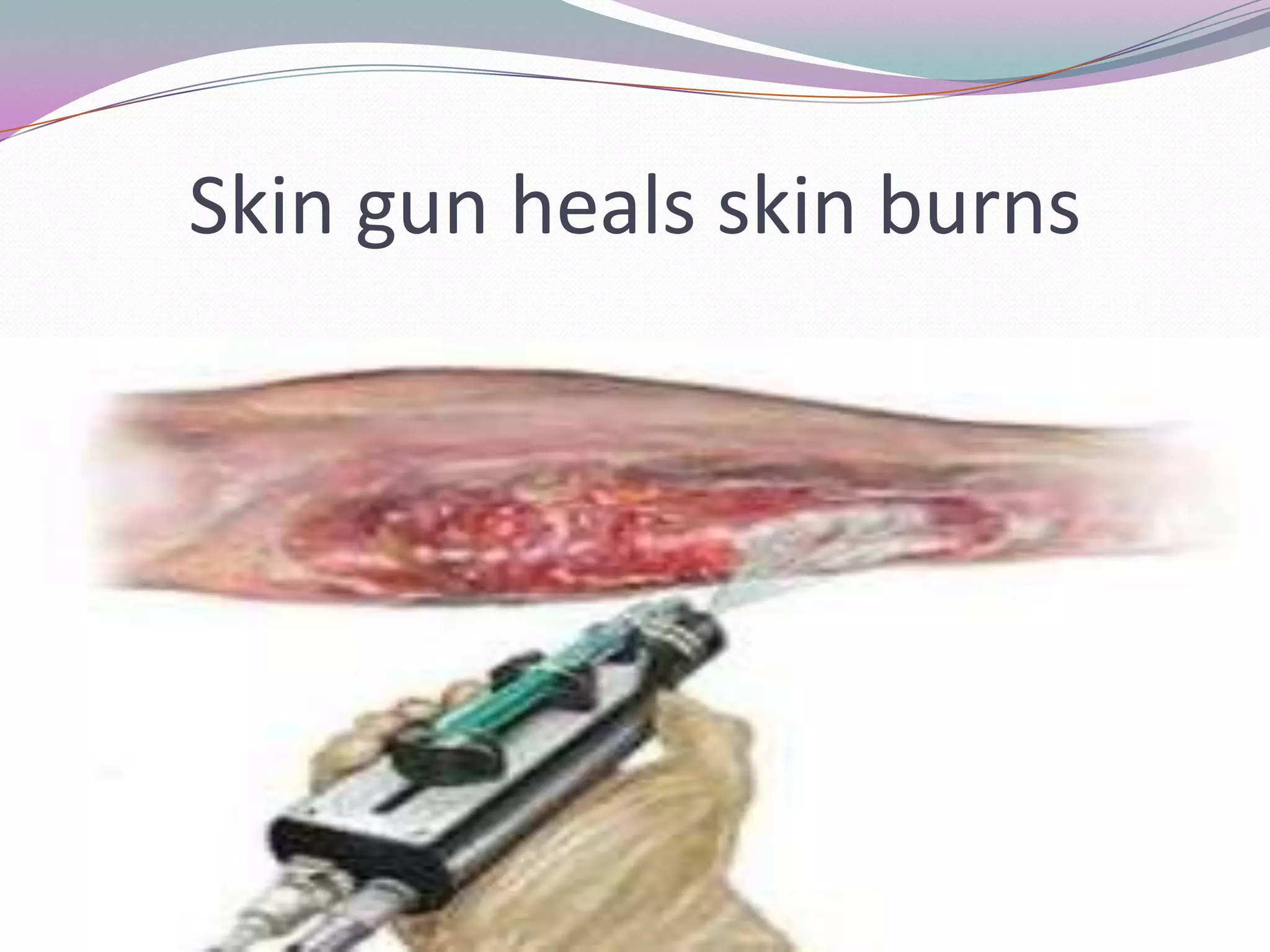 Skin gun heals skin burns
 