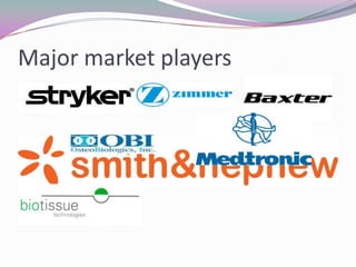 Major market players
 