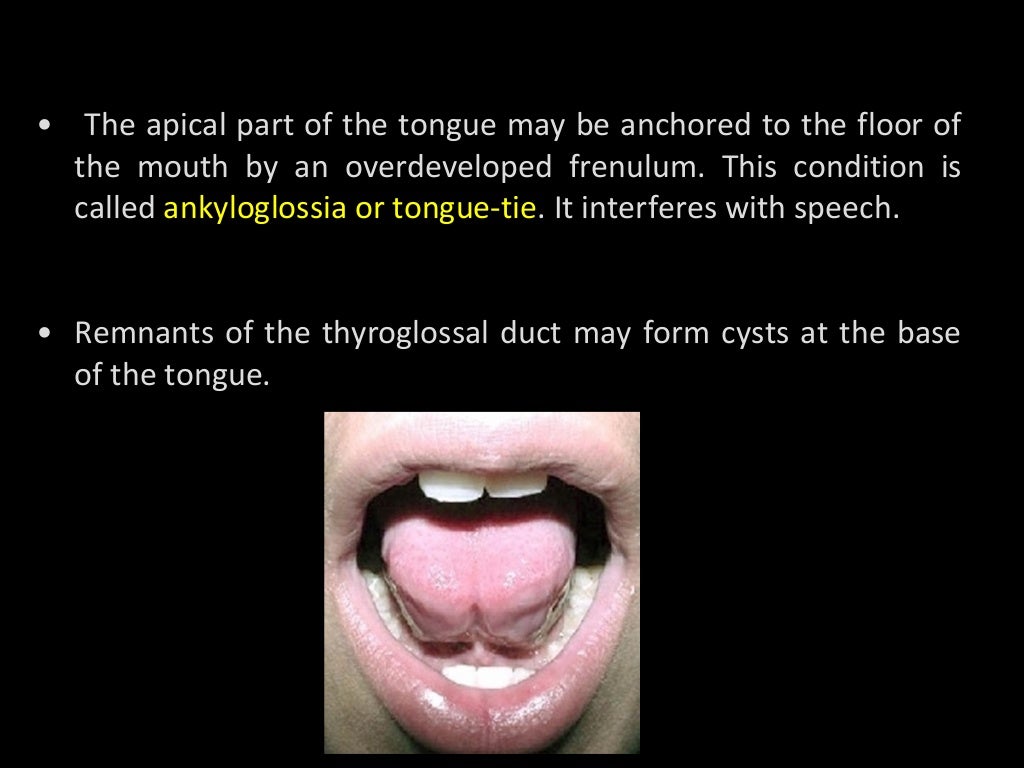 tongue and palate