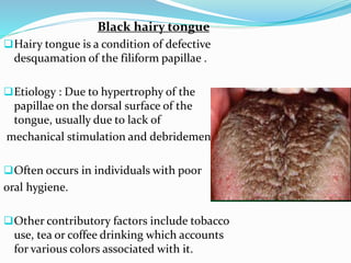 Black hairy tongue
Hairy tongue is a condition of defective
desquamation of the filiform papillae .
Etiology : Due to hypertrophy of the
papillae on the dorsal surface of the
tongue, usually due to lack of
mechanical stimulation and debridement.
Often occurs in individuals with poor
oral hygiene.
Other contributory factors include tobacco
use, tea or coffee drinking which accounts
for various colors associated with it.
 