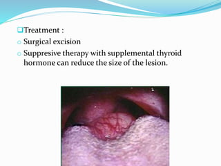 Treatment :
o Surgical excision
o Suppresive therapy with supplemental thyroid
hormone can reduce the size of the lesion.
 