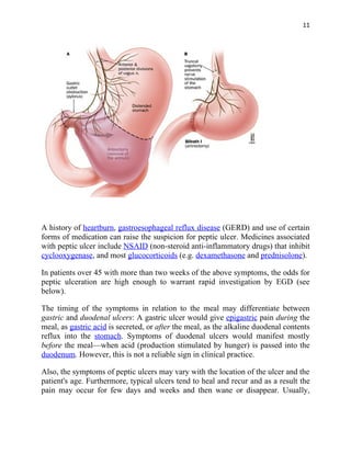 11




A history of heartburn, gastroesophageal reflux disease (GERD) and use of certain
forms of medication can raise the suspicion for peptic ulcer. Medicines associated
with peptic ulcer include NSAID (non-steroid anti-inflammatory drugs) that inhibit
cyclooxygenase, and most glucocorticoids (e.g. dexamethasone and prednisolone).

In patients over 45 with more than two weeks of the above symptoms, the odds for
peptic ulceration are high enough to warrant rapid investigation by EGD (see
below).

The timing of the symptoms in relation to the meal may differentiate between
gastric and duodenal ulcers: A gastric ulcer would give epigastric pain during the
meal, as gastric acid is secreted, or after the meal, as the alkaline duodenal contents
reflux into the stomach. Symptoms of duodenal ulcers would manifest mostly
before the meal—when acid (production stimulated by hunger) is passed into the
duodenum. However, this is not a reliable sign in clinical practice.

Also, the symptoms of peptic ulcers may vary with the location of the ulcer and the
patient's age. Furthermore, typical ulcers tend to heal and recur and as a result the
pain may occur for few days and weeks and then wane or disappear. Usually,
 