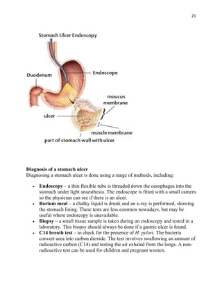 21




Diagnosis of a stomach ulcer
Diagnosing a stomach ulcer is done using a range of methods, including:

   •   Endoscopy – a thin flexible tube is threaded down the oesophagus into the
       stomach under light anaesthesia. The endoscope is fitted with a small camera
       so the physician can see if there is an ulcer.
   •   Barium meal – a chalky liquid is drunk and an x-ray is performed, showing
       the stomach lining. These tests are less common nowadays, but may be
       useful where endoscopy is unavailable.
   •   Biopsy – a small tissue sample is taken during an endoscopy and tested in a
       laboratory. This biopsy should always be done if a gastric ulcer is found.
   •   C14 breath test – to check for the presence of H. pylori. The bacteria
       convert urea into carbon dioxide. The test involves swallowing an amount of
       radioactive carbon (C14) and testing the air exhaled from the lungs. A non-
       radioactive test can be used for children and pregnant women.
 