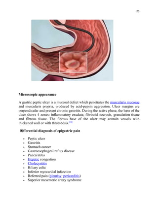 23




Microscopic appearance

A gastric peptic ulcer is a mucosal defect which penetrates the muscularis mucosae
and muscularis propria, produced by acid-pepsin aggression. Ulcer margins are
perpendicular and present chronic gastritis. During the active phase, the base of the
ulcer shows 4 zones: inflammatory exudate, fibrinoid necrosis, granulation tissue
and fibrous tissue. The fibrous base of the ulcer may contain vessels with
thickened wall or with thrombosis.[19]

Differential diagnosis of epigastric pain

   •   Peptic ulcer
   •   Gastritis
   •   Stomach cancer
   •   Gastroesophageal reflux disease
   •   Pancreatitis
   •   Hepatic congestion
   •   Cholecystitis
   •   Biliary colic
   •   Inferior myocardial infarction
   •   Referred pain (pleurisy, pericarditis)
   •   Superior mesenteric artery syndrome
 