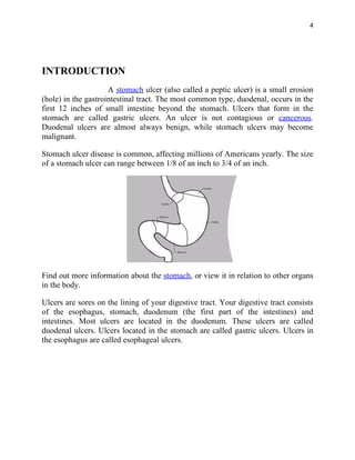 4




INTRODUCTION
                     A stomach ulcer (also called a peptic ulcer) is a small erosion
(hole) in the gastrointestinal tract. The most common type, duodenal, occurs in the
first 12 inches of small intestine beyond the stomach. Ulcers that form in the
stomach are called gastric ulcers. An ulcer is not contagious or cancerous.
Duodenal ulcers are almost always benign, while stomach ulcers may become
malignant.

Stomach ulcer disease is common, affecting millions of Americans yearly. The size
of a stomach ulcer can range between 1/8 of an inch to 3/4 of an inch.




Find out more information about the stomach, or view it in relation to other organs
in the body.

Ulcers are sores on the lining of your digestive tract. Your digestive tract consists
of the esophagus, stomach, duodenum (the first part of the intestines) and
intestines. Most ulcers are located in the duodenum. These ulcers are called
duodenal ulcers. Ulcers located in the stomach are called gastric ulcers. Ulcers in
the esophagus are called esophageal ulcers.
 