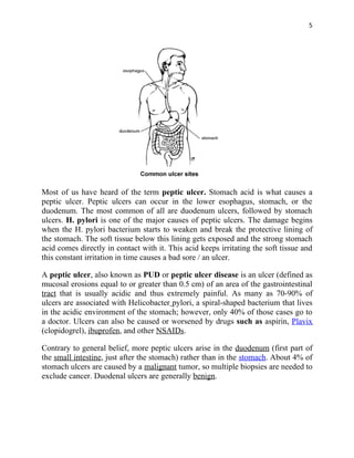 5




Most of us have heard of the term peptic ulcer. Stomach acid is what causes a
peptic ulcer. Peptic ulcers can occur in the lower esophagus, stomach, or the
duodenum. The most common of all are duodenum ulcers, followed by stomach
ulcers. H. pylori is one of the major causes of peptic ulcers. The damage begins
when the H. pylori bacterium starts to weaken and break the protective lining of
the stomach. The soft tissue below this lining gets exposed and the strong stomach
acid comes directly in contact with it. This acid keeps irritating the soft tissue and
this constant irritation in time causes a bad sore / an ulcer.

A peptic ulcer, also known as PUD or peptic ulcer disease is an ulcer (defined as
mucosal erosions equal to or greater than 0.5 cm) of an area of the gastrointestinal
tract that is usually acidic and thus extremely painful. As many as 70-90% of
ulcers are associated with Helicobacter pylori, a spiral-shaped bacterium that lives
in the acidic environment of the stomach; however, only 40% of those cases go to
a doctor. Ulcers can also be caused or worsened by drugs such as aspirin, Plavix
(clopidogrel), ibuprofen, and other NSAIDs.

Contrary to general belief, more peptic ulcers arise in the duodenum (first part of
the small intestine, just after the stomach) rather than in the stomach. About 4% of
stomach ulcers are caused by a malignant tumor, so multiple biopsies are needed to
exclude cancer. Duodenal ulcers are generally benign.
 