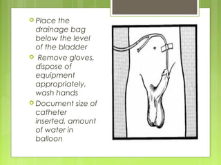 Final urinary bladder catheterisation | PPT