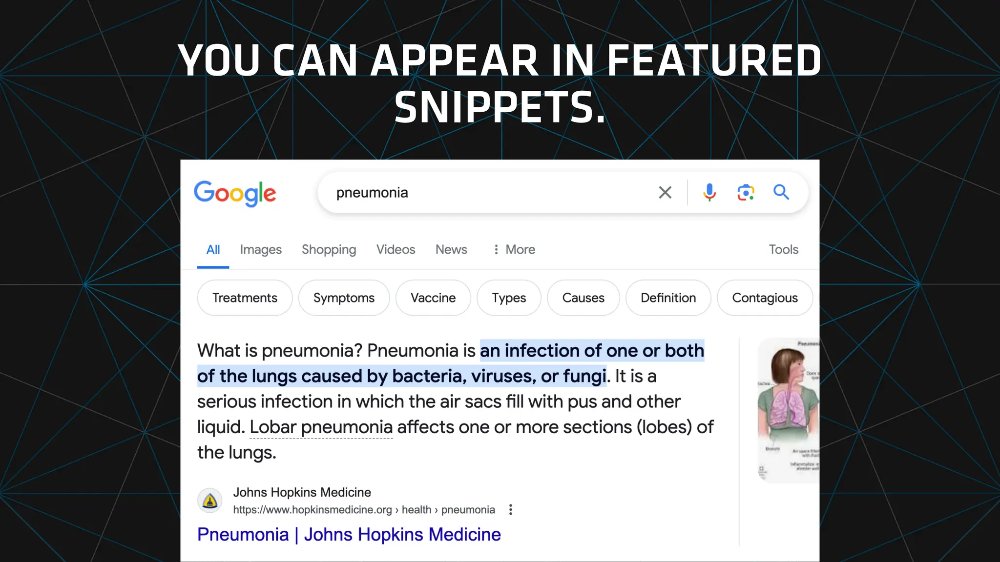 YOU CAN APPEAR IN FEATURED
SNIPPETS.
 