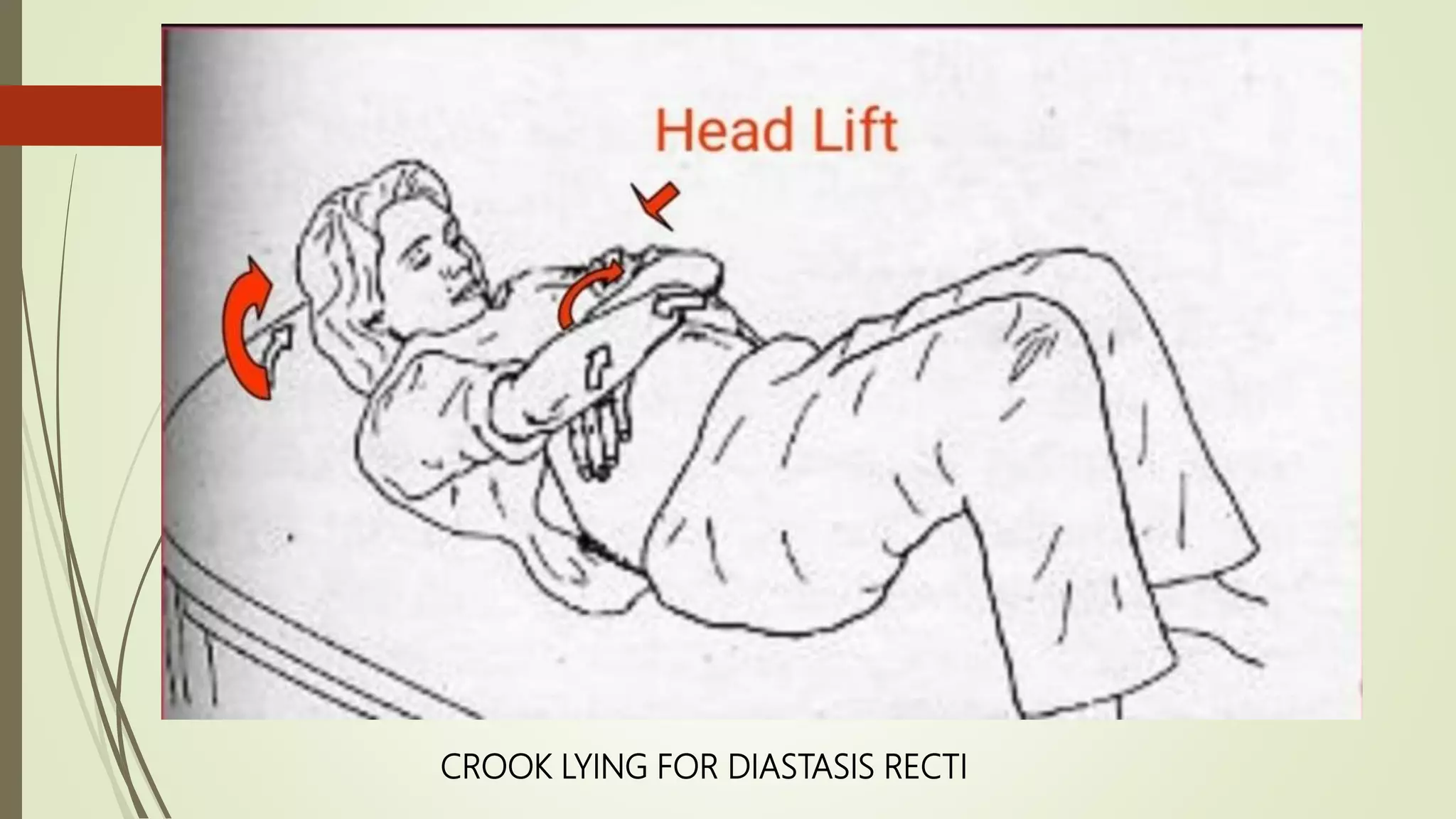 PT IN OBSTETRICS | PPTX