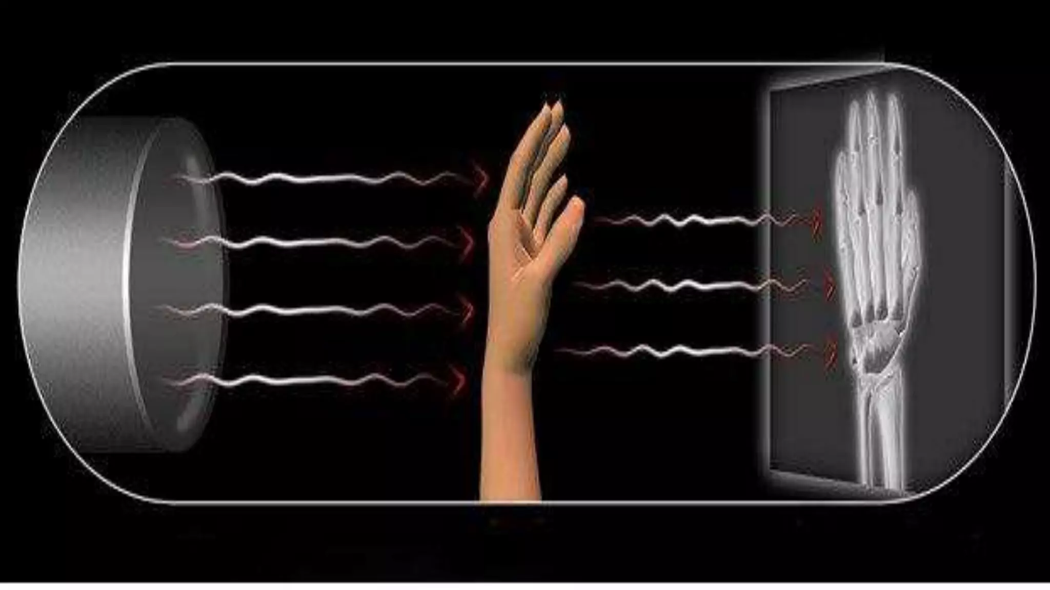 X Ray physics XRay Tube, Transformer, Generator and Rectifiers by