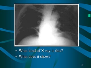41
• What kind of X-ray is this?
• What does it show?
 