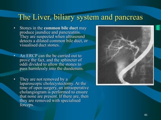 46
The Liver, biliary system and pancreas
• Stones in the common bile duct may
produce jaundice and pancreatitis.
They are suspected when ultrasound
detects a dilated common bile duct, or
visualised duct stones.
• An ERCP can the be carried out to
prove the fact, and the sphincter of
oddi divided to allow the stones to
pass harmlessly into the duodenum.
• They are not removed by a
laparoscopic cholecystectomy. At the
time of open surgery, an intraoperative
cholangiogram is performed to ensure
that none are present. If there are, then
they are removed with specialised
forceps.
 