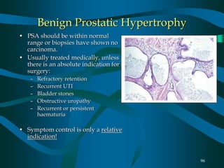 96
Benign Prostatic Hypertrophy
• PSA should be within normal
range or biopsies have shown no
carcinoma.
• Usually treated medically, unless
there is an absolute indication for
surgery:
– Refractory retention
– Recurrent UTI
– Bladder stones
– Obstructive uropathy
– Recurrent or persistent
haematuria
• Symptom control is only a relative
indication!
 