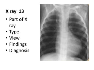final year X rays viva.pptx
