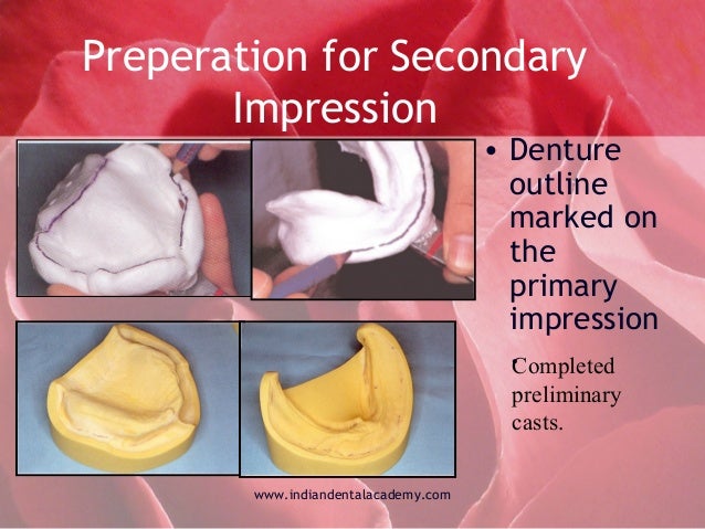 primary impression magdalene project org primary impression