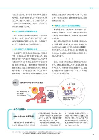 11
ることがあります。そのため、骨転移では、食欲が
なくなる、十分な睡眠がとれないなどの体力、気
力、QOLの低下や、場合によっては動けない、1人
で歩けないなどの重度のQOL低下につながること
が大きな問題となります。
◆◆前立腺がんの骨転移の検査
　前立腺がんの骨転移の有無や広がりの程度
は、骨シンチグラフィー※
（骨シンチ）やCT、MRI
などの画像検査で確認します。また、血液検査で
ALPなどの骨代謝マーカーも調べます。
◆◆前立腺がんの骨転移の治療
　前立腺がんの骨転移の治療法には、①骨折の
予防・治療のために骨を器具で補強したり、骨転
移を取り除いて人工の骨や補強材を入れたりす
る整形外科的な手術療法、②痛みや手足のしび
れ・麻痺（脊髄圧迫）、病的骨折の予防に対する
放射線療法、③主に破骨細胞に作用し、骨が過
剰に破壊されるのを阻止するビスホスホネート
製剤や抗ランクル抗体などの骨修飾薬による薬
物療法、④主に痛みを和らげるオピオイド、非ス
テロイド性消炎鎮痛薬、鎮痛補助薬などによる薬
物療法があります。
◆◆骨転移に対する緩和放射線療法
　痛みや手足のしびれ・麻痺、病的骨折に対す
る緩和放射線療法としては、骨転移のある部位
に体の外から放射線をあてる外照射が第一選択
になります。
　また、骨の代謝が活発な骨転移巣に集積しや
すい性質を持つRIを注射して体内に投与し、体
の内部から放射線をあてるRI内用療法（図表8）
があります。さらに、オリゴメタ（少数転移）の
ときには、前立腺または転移部位に照射を行う
試みもあります。
＊　＊　＊
　このように様々な治療法や緩和療法がありま
すが、早期に適切に対処してもらうためには、痛
みやしびれ、麻痺などの症状を感じたら、担当
医や看護師などの医療スタッフにすぐに具体的
に伝えることが大切です。
骨に集積しやすい
性質を持つ
放射性医薬品
がん細胞
骨転移巣
RI
骨転移に対するRI内用療法図表８
RI
α線やβ線
骨転移（がん細胞）に
放射線があたる
※骨シンチグラフィー：がんの病巣に集まる性質をもつ、放射性物質を含む薬剤を血管内に投与した後に撮影し、
	 がんのある部位に薬剤が集まって黒く映し出されることで転移の部位が分かる検査。
放射線療法と非再発率
　
　放射線療法では、線量を増やすこ
とと内分泌療法との併用が、非再発率
の改善に寄与するといわれています。
　非再発率の向上には、副作用を抑
えつつ、どれだけ多くの線量を照射
できるかがポイントとなります。
　内分泌療法の併用期間は、中間リス
クでは治療前に４〜６カ月程度、高リ
スクでは治療前・治療後の合計が 2〜
3年とされていますが（P.8 図表５）、副
作用が強く現れる人にとっては、内分
泌療法の長期化は辛い場合がありま
す。併用期間については医師と相談し
ておくとよいでしょう。
 