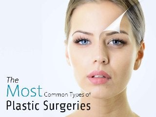 The Most Common Types of
Plastic Surgeries
 