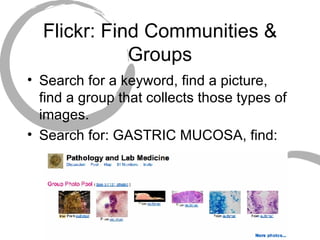 Flickr: Find Communities & Groups Search for a keyword, find a picture, find a group that collects those types of images. Search for: GASTRIC MUCOSA, find: 