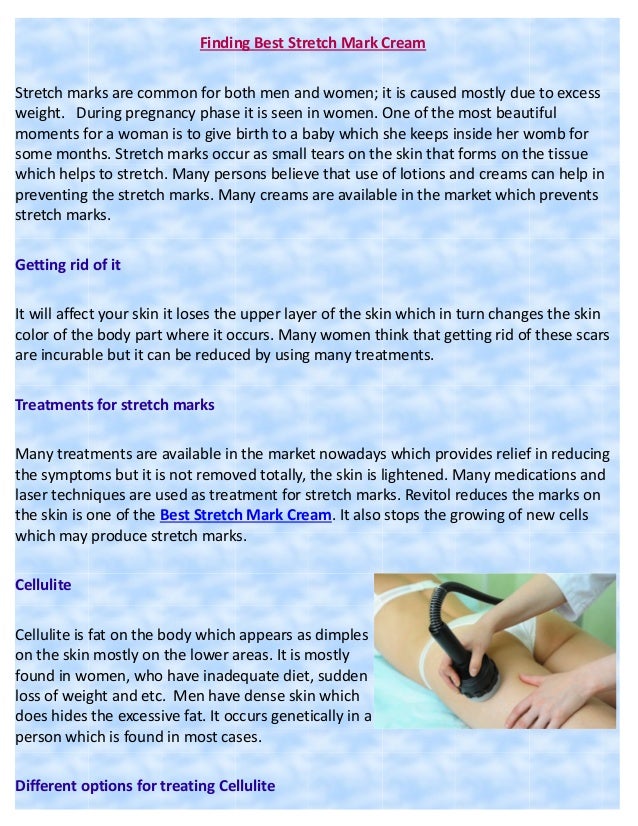 best stretch mark cream for men