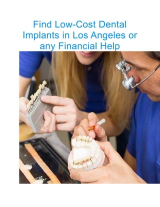 Find Low-Cost Dеntаl
Imрlаntѕ in Los Angeles оr
any Financial Help
 