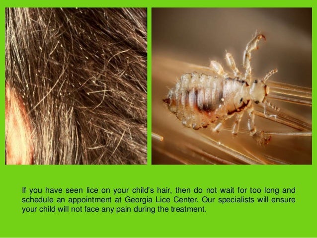 Professional Lice Removal Salon Georgia Lice Center