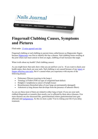Fingernail Clubbing Causes, Symptoms
and Pictures
Filed under 13 mins agonail care tips
Fingernail clubbing or nail clubbing in ancient times called known as Hippocratic fingers
because Hippocrates was first to identify this has a disease. Nail clubbing forms swelling at
the joint where nail meet cuticle to form an angle, clubbing of nail increases that angle.
What it tells about my health? (Nail clubbing causes)
As you might know that nails show what you eat and how you’re. If you want to check your
health status, then check out your nails. Nail clubbing is not caused because of any injury or
fungus affecting your nails, but it’s caused when you experience with anyone of the
following disease.
Pulmonary Fibrosis (scarring in the lungs.)
Tetralogy of Fallot (TOF) (a type of congenital heart defect)
Hodgkin’s lymphoma (a cancer of lymph tissue)
Bronchiectasis (bronchial tubes of your lungs are permanently damaged)
Asbestosis (a lung disease that develops from the presence of asbestos fibers)
As you see these most of them are related to either lung or heart. If you see your nails
clubbed (fingernails or toenails) then mostly you’re affected by these above diseases. Few
more diseases are also discussed like, gastrointestinal (where gastrointestinal tract gets
affected) and malignancies. So this no more a joke! You’re risking your life if you delay
treatment.

 
