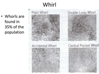 Tooth Pattern Csi CSI'/ Forensics Fingerprint Identification | PPTX