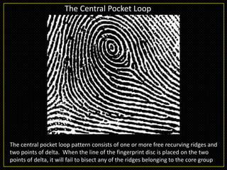 Recorving Ridges Finger print | PPTX