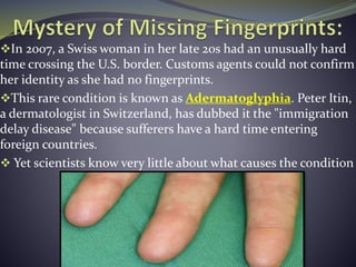 In 2007, a Swiss woman in her late 20s had an unusually hard
time crossing the U.S. border. Customs agents could not confirm
her identity as she had no fingerprints.
This rare condition is known as Adermatoglyphia. Peter Itin,
a dermatologist in Switzerland, has dubbed it the "immigration
delay disease" because sufferers have a hard time entering
foreign countries.
 Yet scientists know very little about what causes the condition
 
