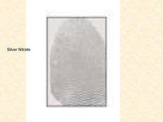 Silver Nitrate
 