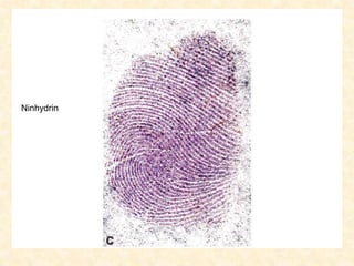 Ninhydrin
 