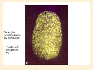 Super glue
developed under
UV illumination
Treated with
Rhodamine-
6G
 