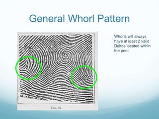 General Whorl Pattern
Whorls will always
have at least 2 valid
Deltas located within
the print
 