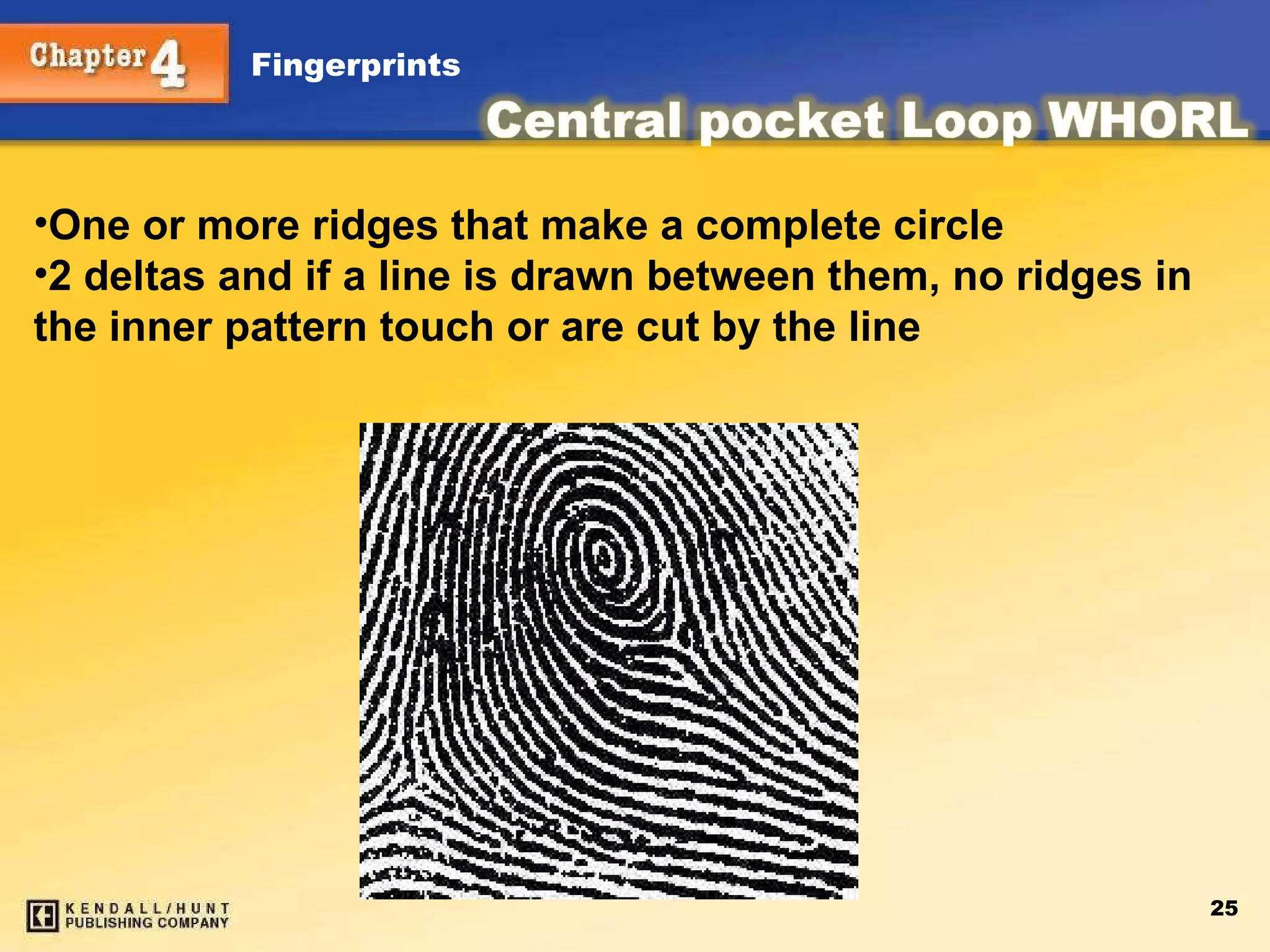 One or more ridges that make a complete circle 2 deltas and if a line is drawn between them, no ridges in the inner pattern touch or are cut by the line 