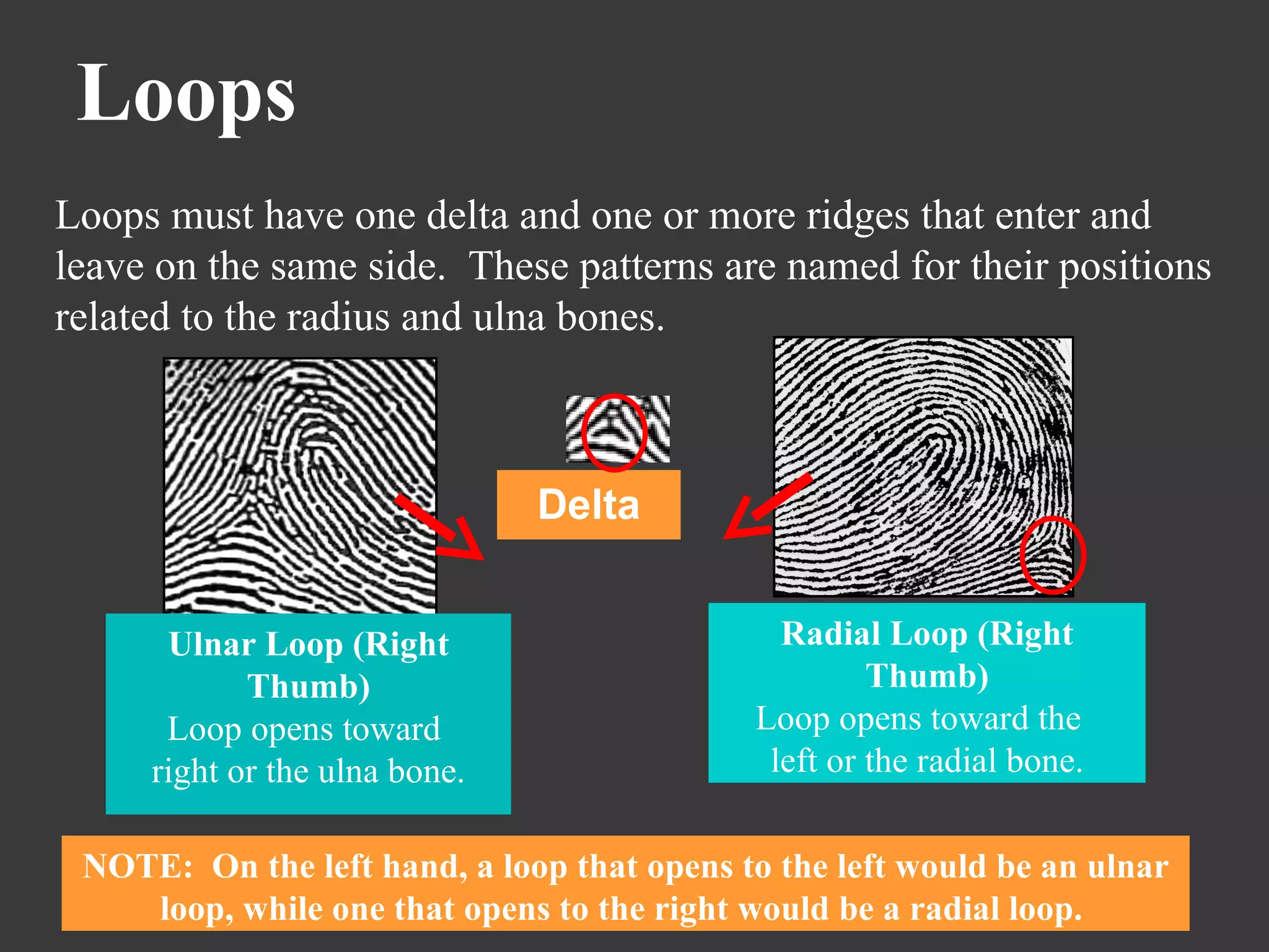 Loops Loops must have one delta and one or more ridges that enter and leave on the same side.  These patterns are named for their positions related to the radius and ulna bones. NOTE:  On the left hand, a loop that opens to the left would be an ulnar loop, while one that opens to the right would be a radial loop.  Delta Ulnar Loop (Right Thumb) Loop opens toward  right or the ulna bone. Radial Loop (Right Thumb) Loop opens toward the  left or the radial bone. 