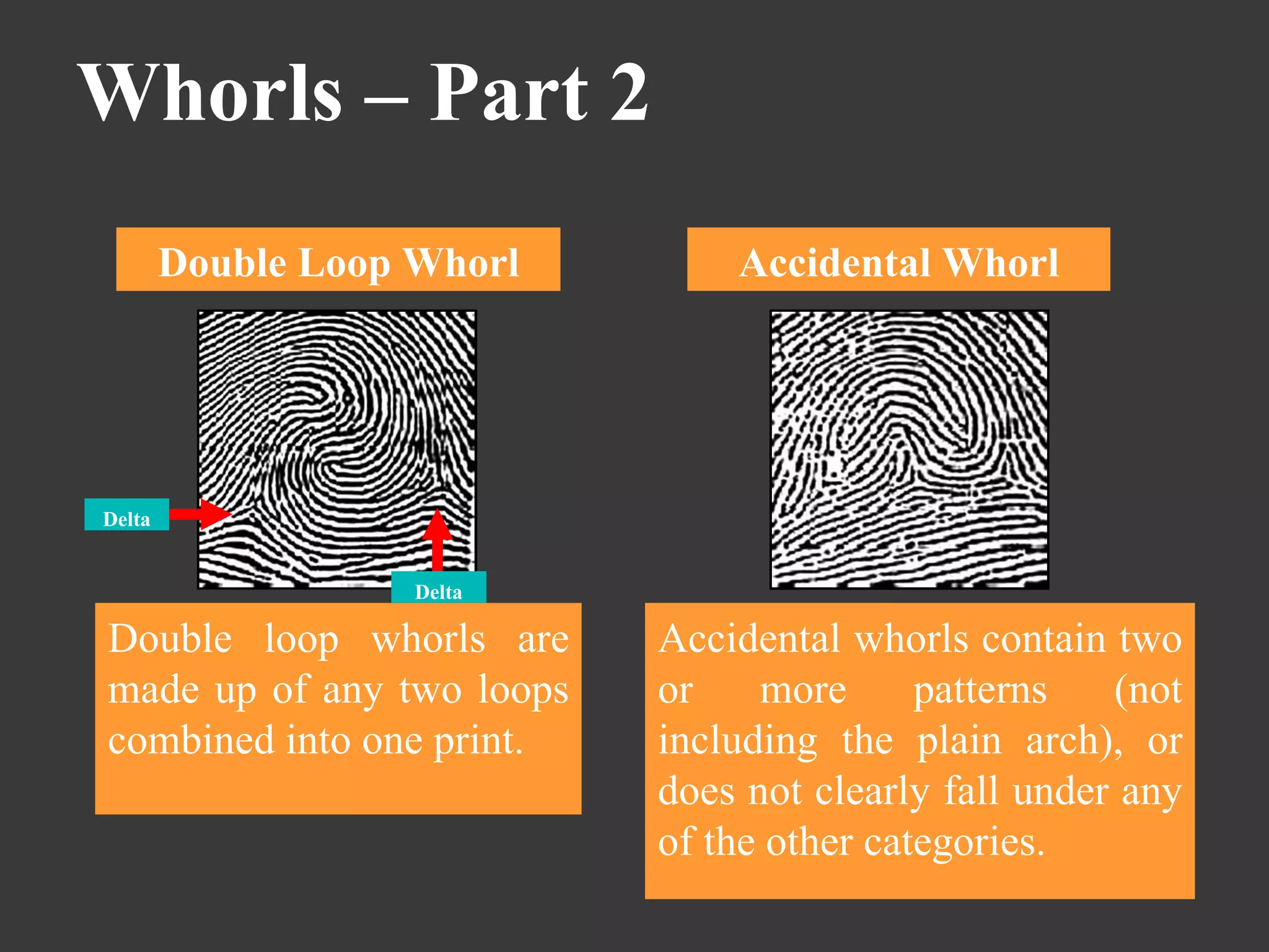 Whorls – Part 2 Accidental Whorl Accidental whorls contain two or more patterns (not including the plain arch), or does not clearly fall under any of the other categories.  Double Loop Whorl Double loop whorls are made up of any two loops combined into one print.  Delta Delta 