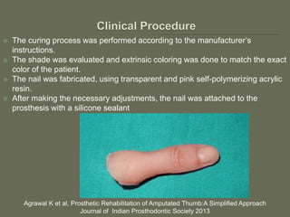  The curing process was performed according to the manufacturer’s
instructions.
 The shade was evaluated and extrinsic coloring was done to match the exact
color of the patient.
 The nail was fabricated, using transparent and pink self-polymerizing acrylic
resin.
 After making the necessary adjustments, the nail was attached to the
prosthesis with a silicone sealant
Agrawal K et al, Prosthetic Rehabilitation of Amputated Thumb:A Simplified Approach
Journal of Indian Prosthodontic Society 2013
 