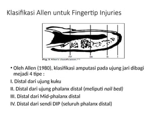 sharing tentang materi Finger Tip Injuries.pptx
