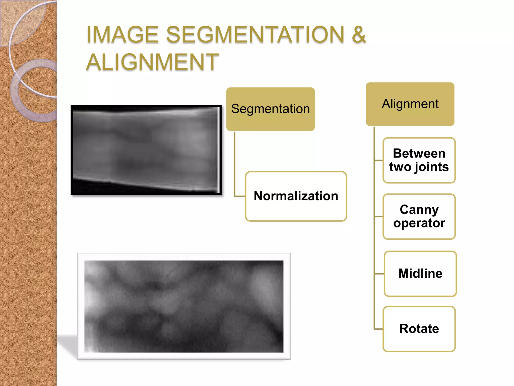 IMAGE SEGMENTATION &
ALIGNMENT
Segmentation

Alignment

Between
two joints

Normalization
Canny
operator

Midline

Rotate

 