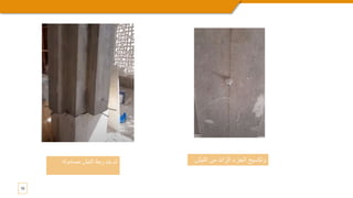 10
‫الت‬ ‫من‬ ‫الزائد‬ ‫الجزء‬ ‫وتكسيح‬
‫يش‬
‫بصامول‬ ‫التيش‬ ‫ربط‬ ‫يتم‬ ‫ثم‬
‫ه‬
 