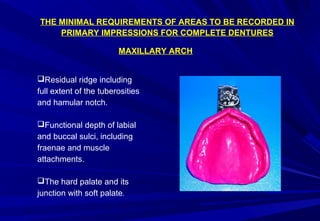 THE MINIMAL REQUIREMENTS OF AREAS TO BE RECORDED IN
PRIMARY IMPRESSIONS FOR COMPLETE DENTURES
MAXILLARY ARCH
Residual ridge including
full extent of the tuberosities
and hamular notch.
Functional depth of labial
and buccal sulci, including
fraenae and muscle
attachments.
The hard palate and its
junction with soft palate.

 