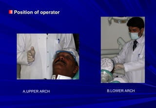 Position of operator

A.UPPER ARCH

B.LOWER ARCH

 