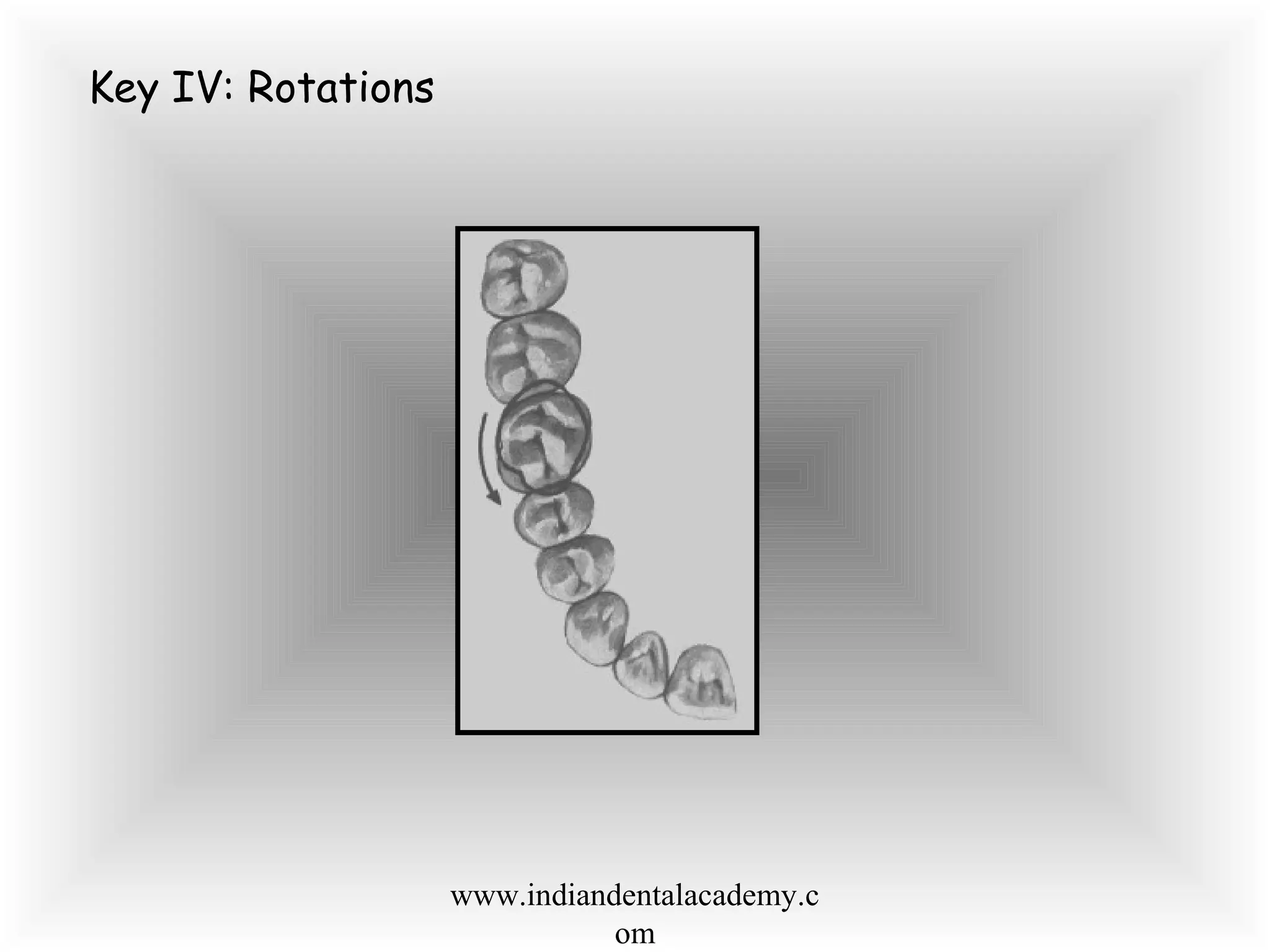 Key IV: Rotations
www.indiandentalacademy.c
om
 