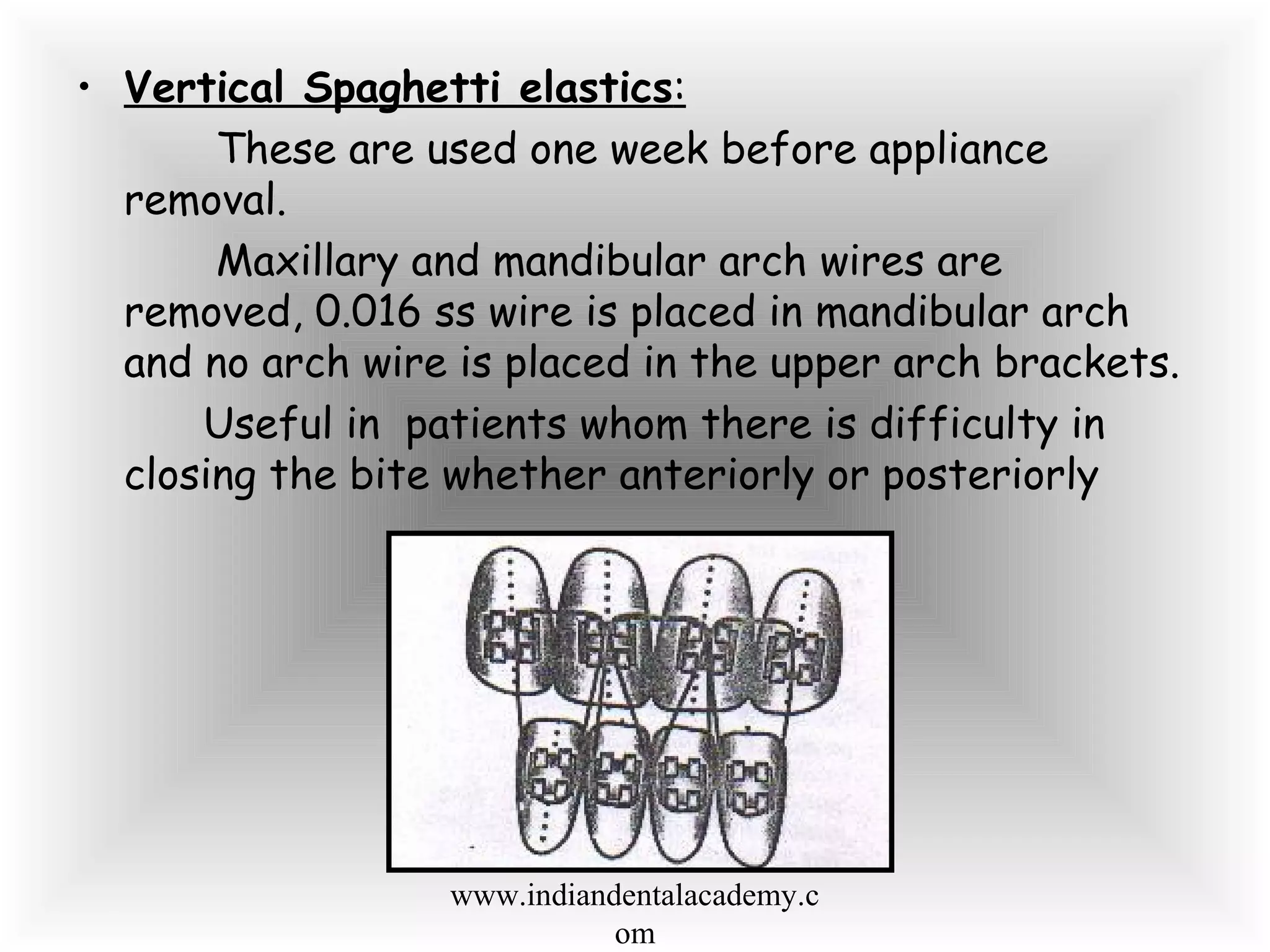 • Vertical Spaghetti elastics:
These are used one week before appliance
removal.
Maxillary and mandibular arch wires are
removed, 0.016 ss wire is placed in mandibular arch
and no arch wire is placed in the upper arch brackets.
Useful in patients whom there is difficulty in
closing the bite whether anteriorly or posteriorly
www.indiandentalacademy.c
om
 